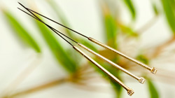 Lai Chee Acupuncture website - column header picture - acupuncture needles on copper