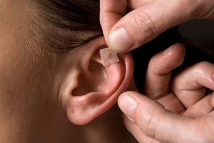 Ear Acupuncture - here using ear seeds ( tiny plant seeds mounted on adhesive tape) applied to Acupuncture points on the ears
