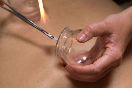 Cupping Therapy can be part of an Acupuncture treatment, and may be used to treat muscular skeletal problems