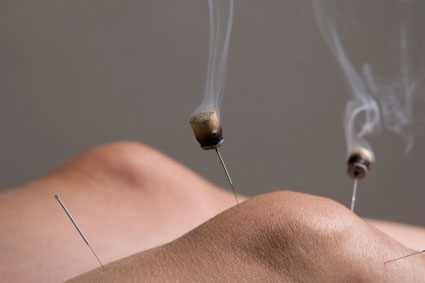 Moxabustion - or Moxa -  is a form of  heat treatment often combined with Acupuncture